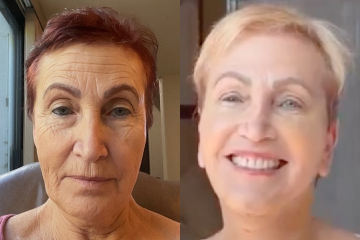 facelift in mexico lori 2026